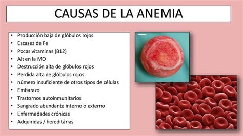 o que causa anemia